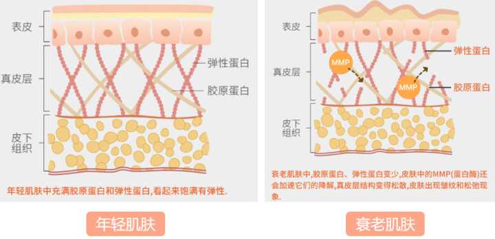 主要的原因还是皮肤慢慢流失了 胶原蛋白 弹性蛋白 糖胺聚糖